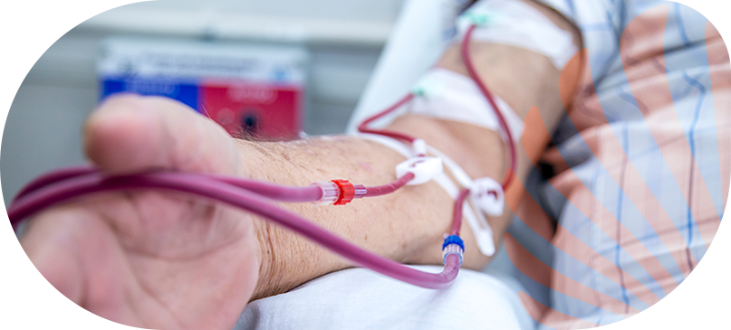 evelyn-boliani-saude-vascular-Implante-de-cateter-fistula-para-hemodialise